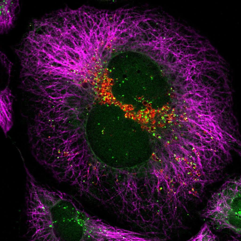 autophagy